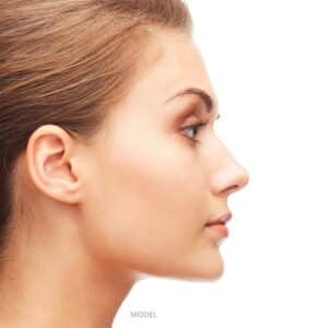 What Can Rhinoplasty Achieve?