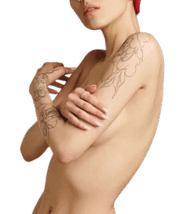 Breast Augmentation