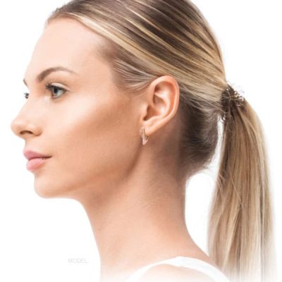 What Can Rhinoplasty Achieve?